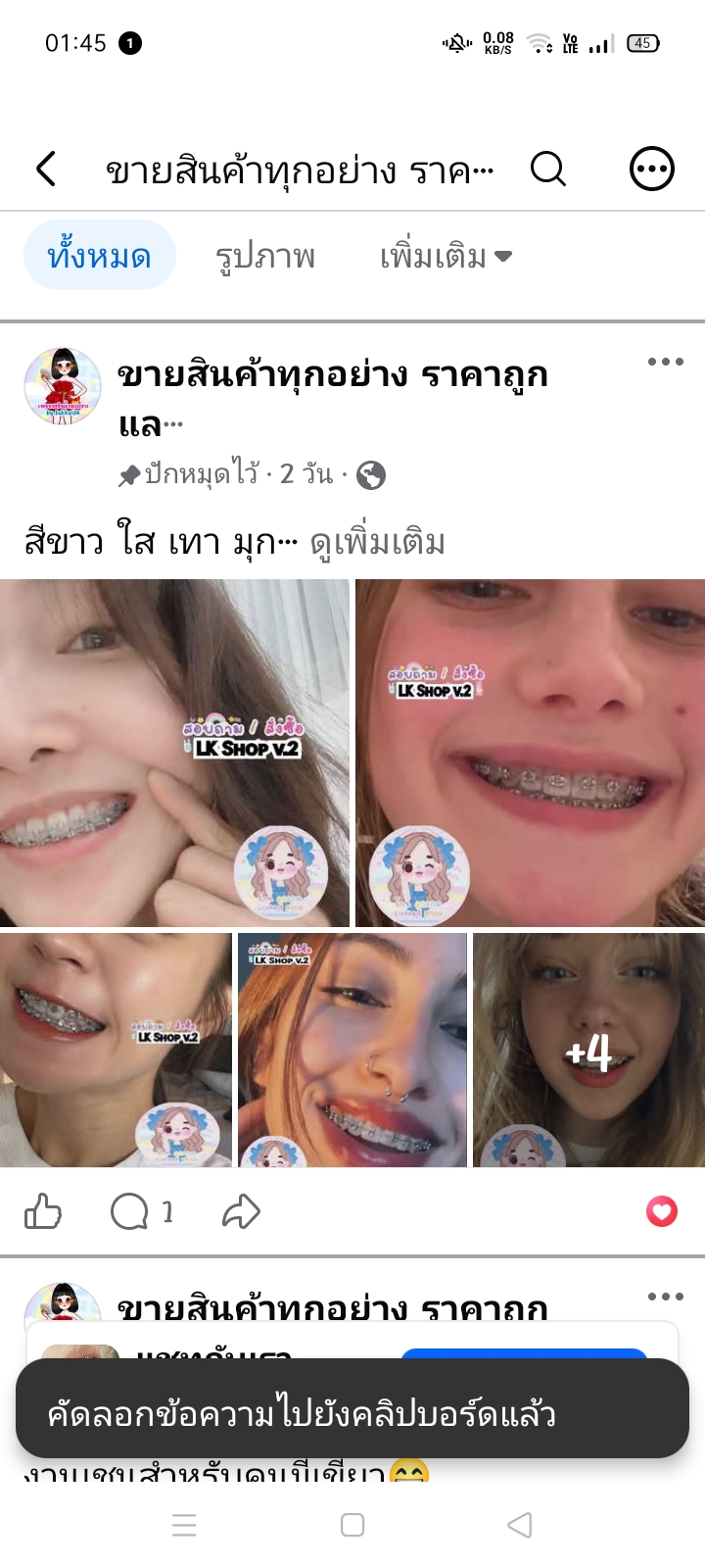 Upper-Lower Retainer
