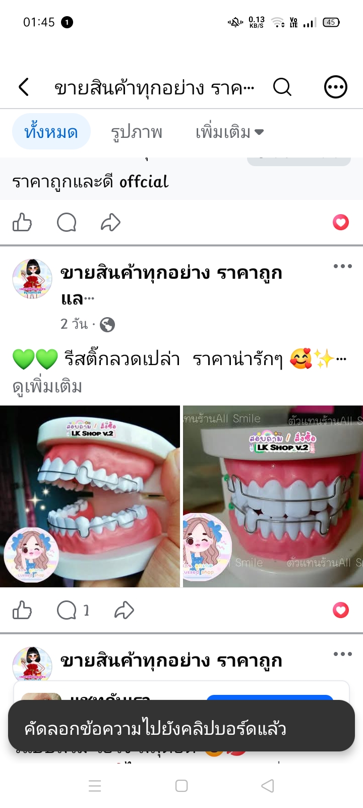 Upper-Lower Retainer